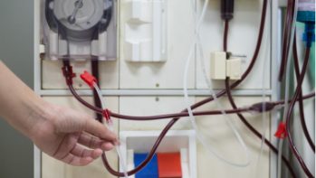 Clearing all safety functions, and connecting acid and bicarbonate solutions to pass the conductivity tests.