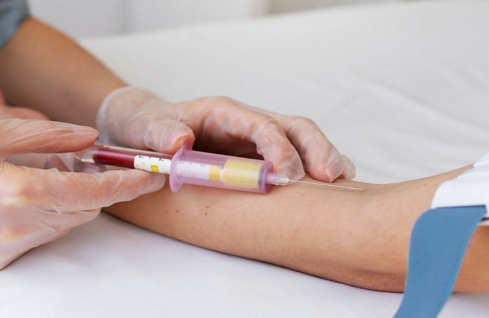 Is hemodialysis permanent